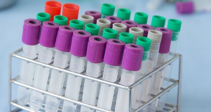 Fortalecemos su cadena  de distribución de muestras biológicas con el mejor servicio