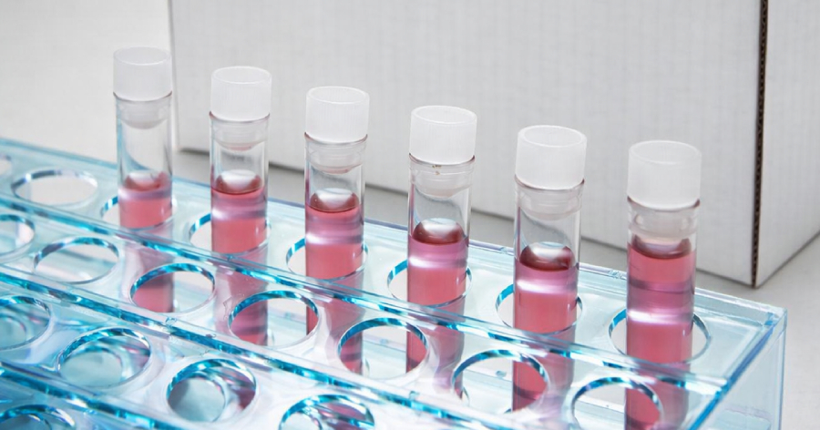 cada-muestra-importa-garantizamos-calidad-precision-y-confianza-en-cada-traslado